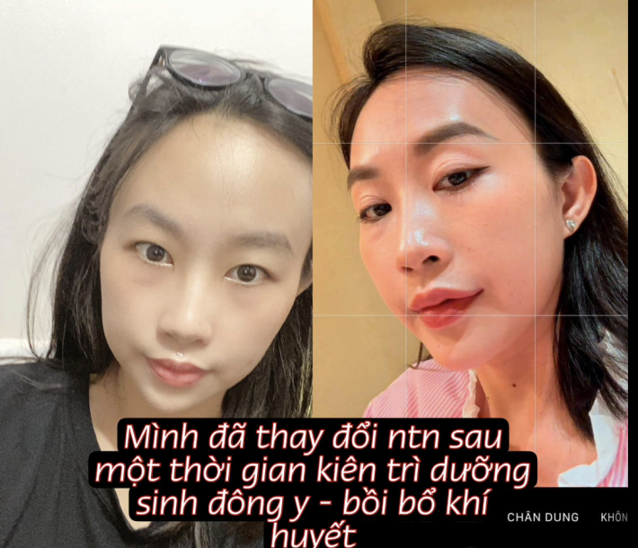MÌNH ĐÃ THAY ĐỔI NHƯ THẾ NÀO KHI BIẾT ĐẾN DƯỠNG SINH ĐÔNG Y ???